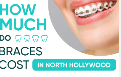 Average Cost of Braces Per Month