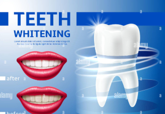 Creative Teeth Whitening