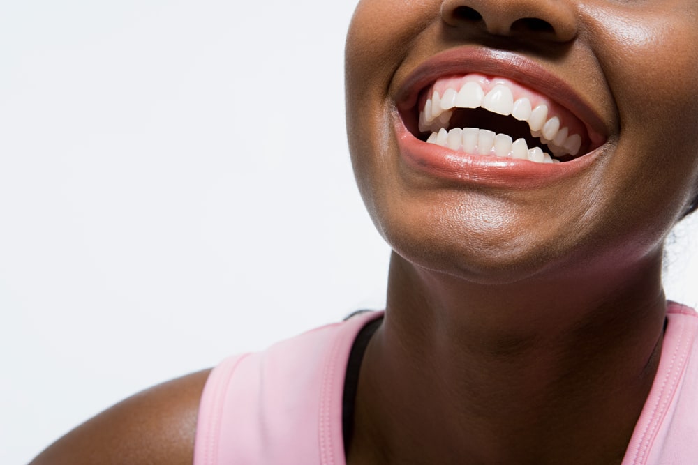 Teeth Whitening for Black Women