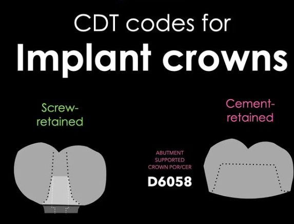 Dental Codes for Implant Crowns