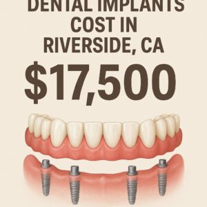 All-on-4 Dental Implant Cost in Riverside CA