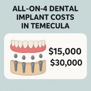 All-on-4 Dental Implant Costs in Temecula