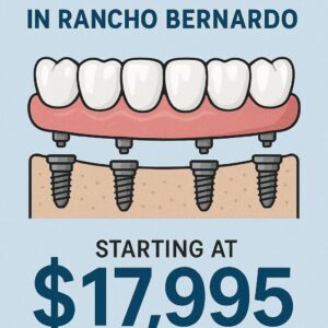 All-on-4 Dental Implants Costs in Rancho Bernardo