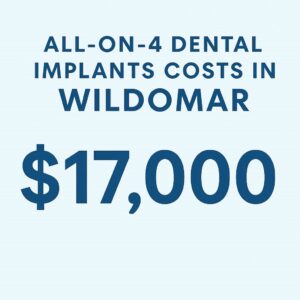 All-on-4 Dental Implants Costs in Wildomar