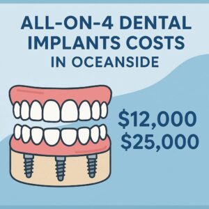 All-on-4 Dental Implants costs in Oceanside