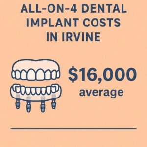 All-on-4 dental implant costs in Irvine