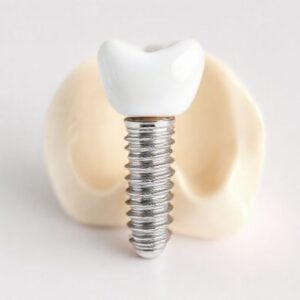 dental implant costs in Oklahoma City