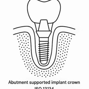 ADA Code for Abutment Supported Implant Crown