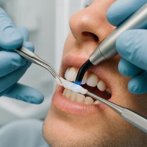 Dental Code for Provisional Splinting