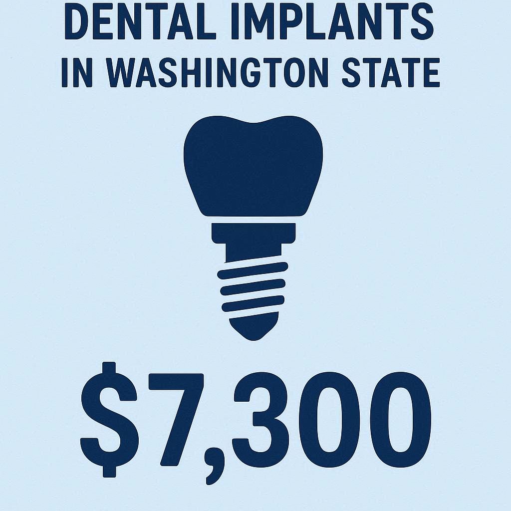 Average Cost of Dental Implants in Washington State