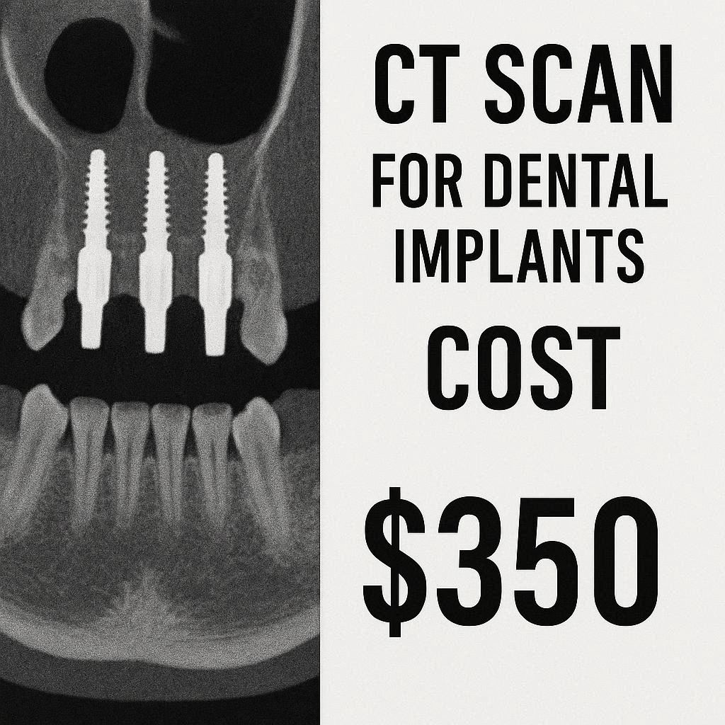 CT Scan for Dental Implants Cost