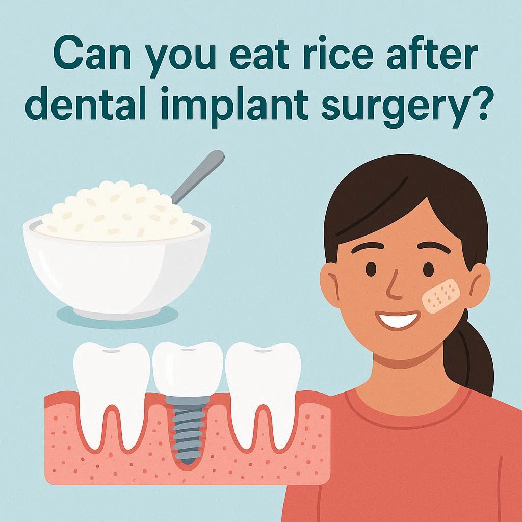 Can You Eat Rice After Dental Implant Surgery?
