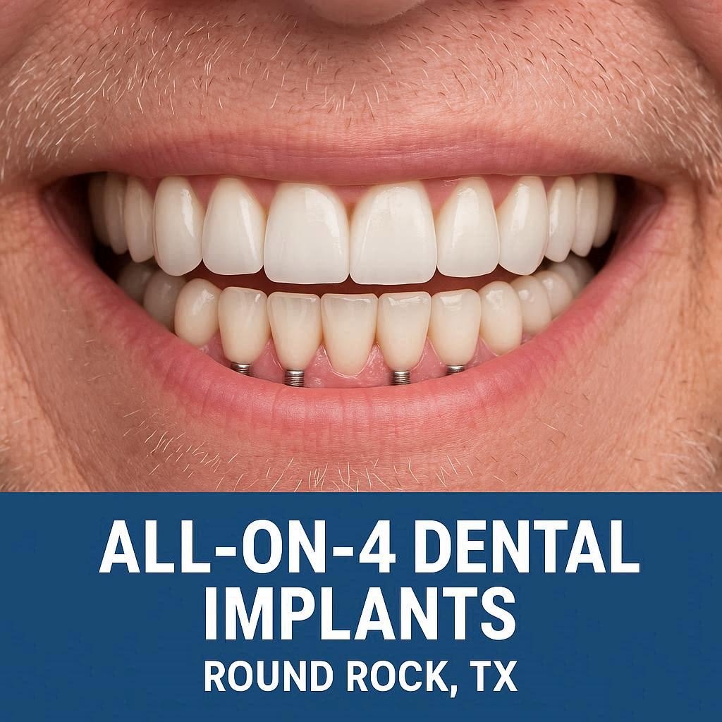 All on 4 Dental Implants in Round Rock TX