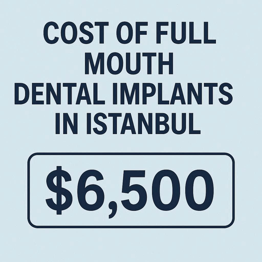 Cost of Full Mouth Dental Implants in Istanbul