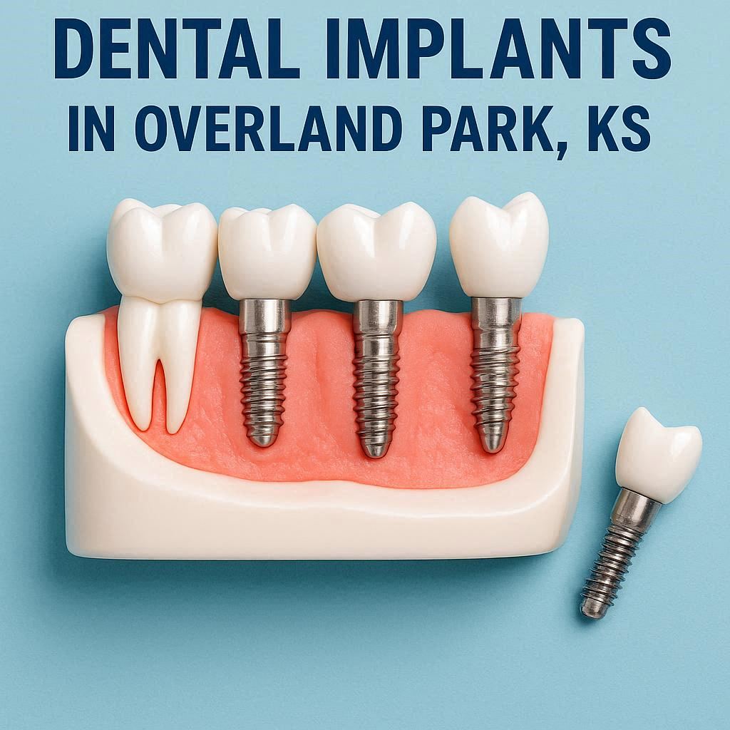 Dental Implants in Overland Park KS