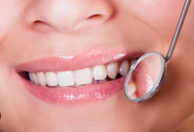 Dental Bonding for Enamel Loss cost