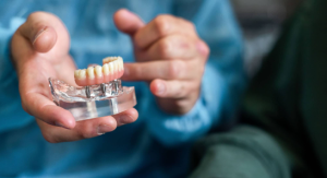 All-on-4 Dental Implants cost in Ohio