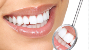 Dental Bonding Cost in Durban