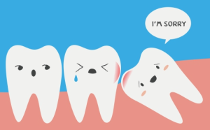 Wisdom Teeth Removal Cost Christchurch