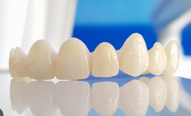 ceramic crown for teeth price