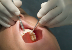 cost of dental implants in guatemala