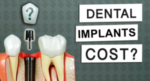 cost of full mouth dental implants in virginia