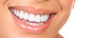 dental bonding cost in kenya