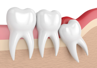 dental bridge cost in jamaica