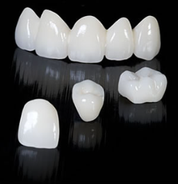 dental crown cost in chennai