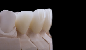 zirconia crown cost in chennai