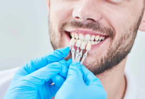 Dental Bonding Cost in Australia