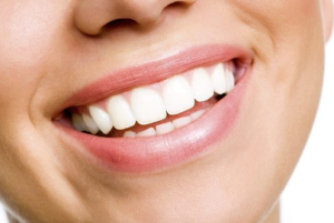 Dental Bonding Cost in Maryland