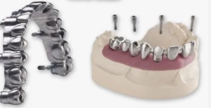 titanium dental implants cost in india