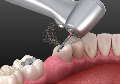 Tooth Extraction Cost in Bahrain