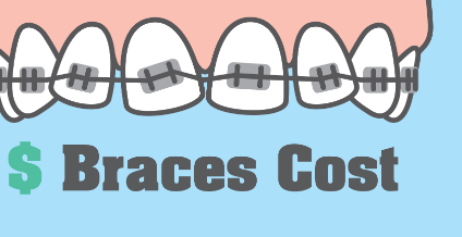 Braces cost in Calgary