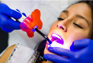 Laser Deep Cleaning Teeth Cost