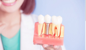 Teeth Cleaning Cost in Chandigarh