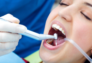 Teeth Cleaning Cost in Faridabad