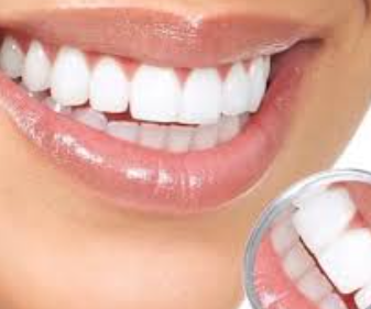 Teeth Cleaning Cost in Jaipur