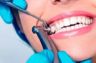 Teeth Cleaning Cost in Uganda