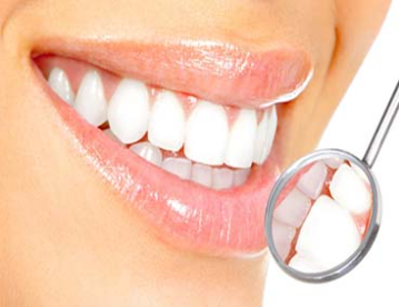 Teeth Cleaning Costs in Ernakulam