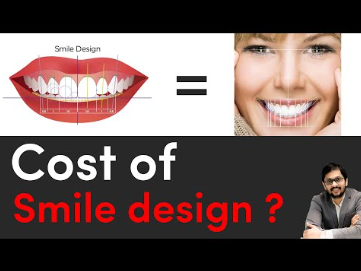 Teeth Cleaning Costs in Indore