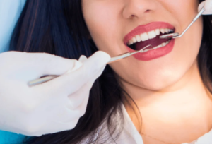 Teeth Cleaning cost in Coimbatore