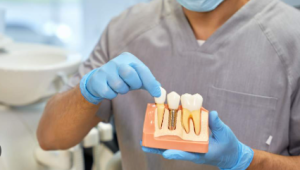 dental implants cost in namibia