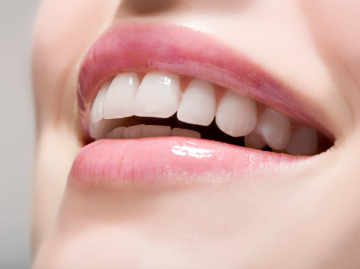 Average Cost of Teeth Whitening