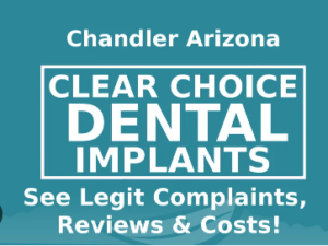 ClearChoice Cost of Dental Implants