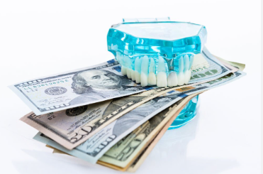 Cost of Dental Implants in Indiana