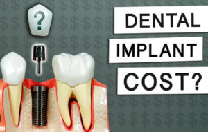 Dental Implant Cost Per Tooth With Insurance