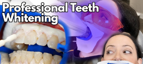 Professional Teeth Whitening Price