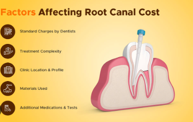 Root Canal Treatment Cost in Government Hospitals